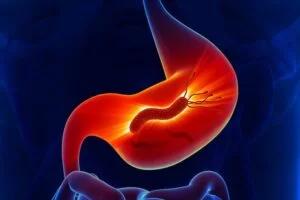 افضل دكتور باطنية