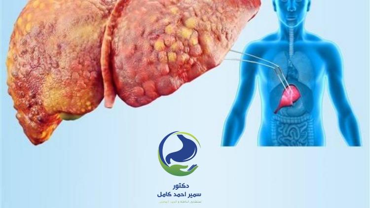 دكتور قولون وجهاز هضمي