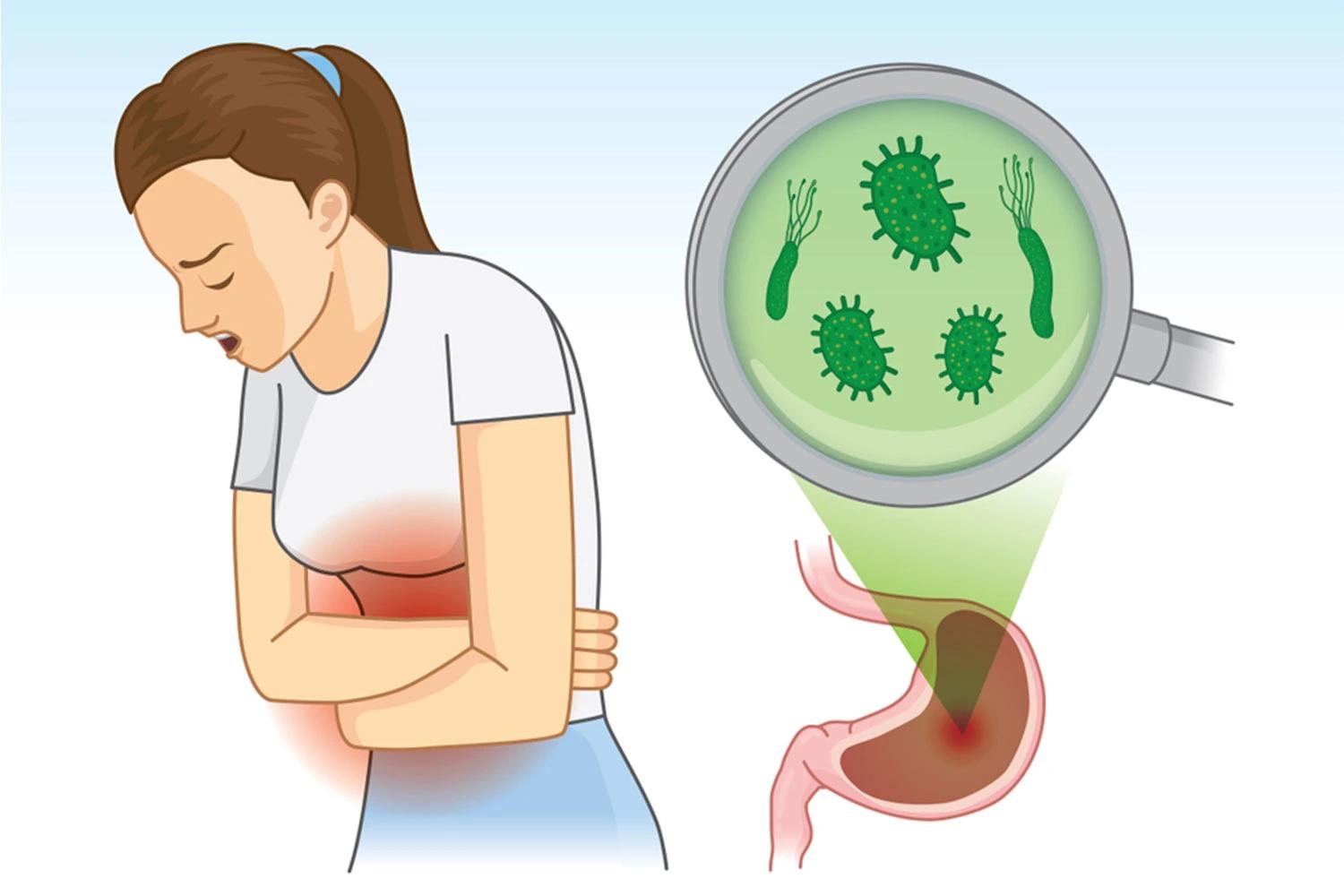 افضل دكتور متخصص في علاج جرثومة المعدة